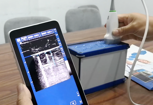 【抗击新冠肺炎】生命学院吴哲教授团队研发智能超声图像识别技术