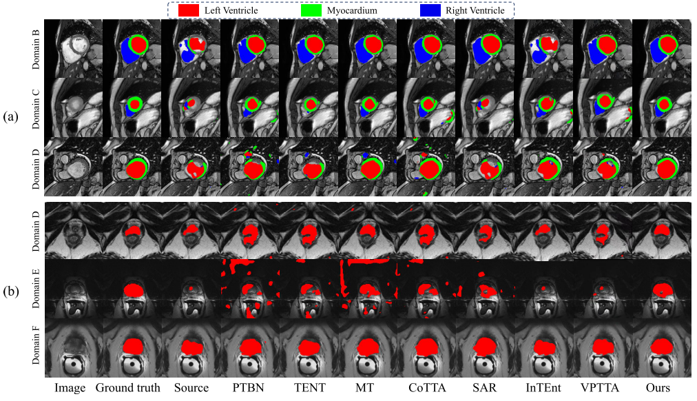 机电学院王国泰团队在人工智能顶级期刊IEEE TIP连续发表两项研究成果