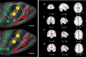 信息医学研究中心最新成果被Nature Asia选为研究亮点