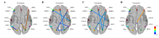 尧德中教授团队在Annals of the New York Academy of Sciences发表封面文章