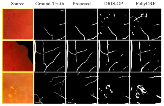 生命学院类脑计算团队博士生在医学人工智能顶级期刊连续发表2项研究成果