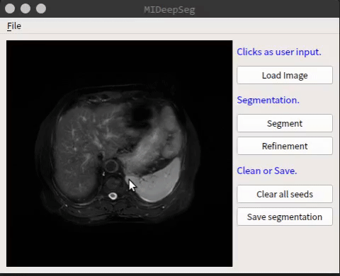机电学院博士生在医学影像人工智能顶级期刊Medical Image Analysis发表论文