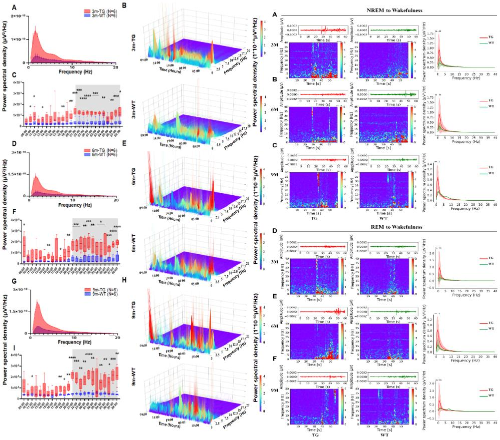 医学院乐卫东教授团队在Alzheimer’s & Dementia发表最新研究成果