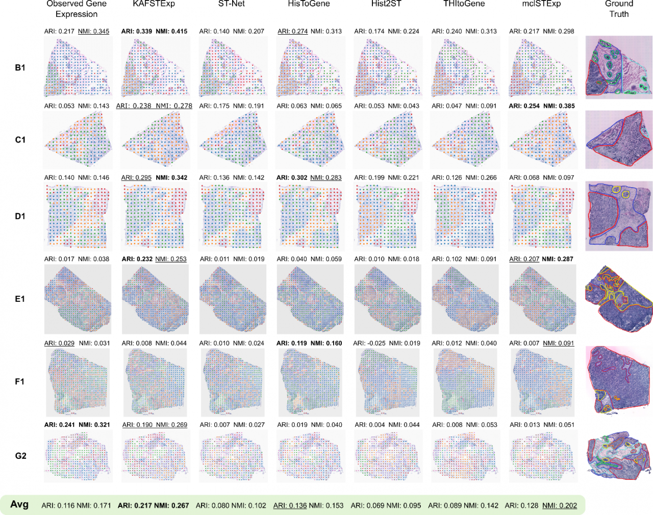 自动化学院谢永乐团队提出空间转录组基因表达预测新方法