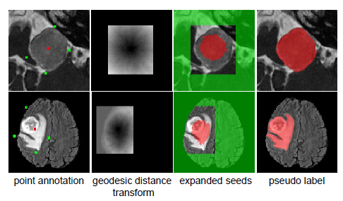 机电学院智慧医疗实验室在医学影像人工智能顶刊发表4项研究成果