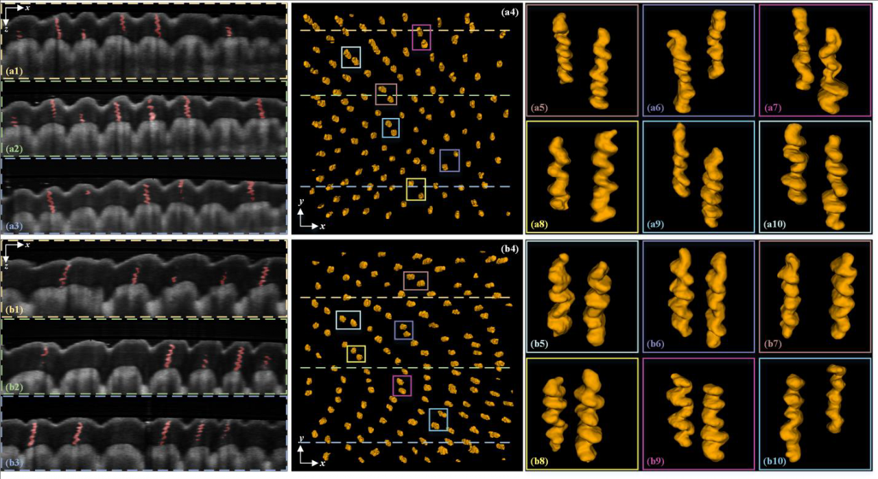光电子器件与应用技术团队连续发表多项医用三维光学成像及处理研究成果