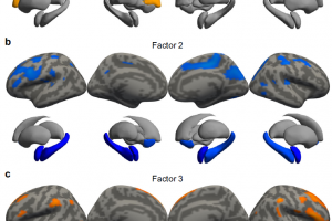 生命学院廖伟陈华富教授团队在Nature Communications发表抑郁症脑影像研究成果