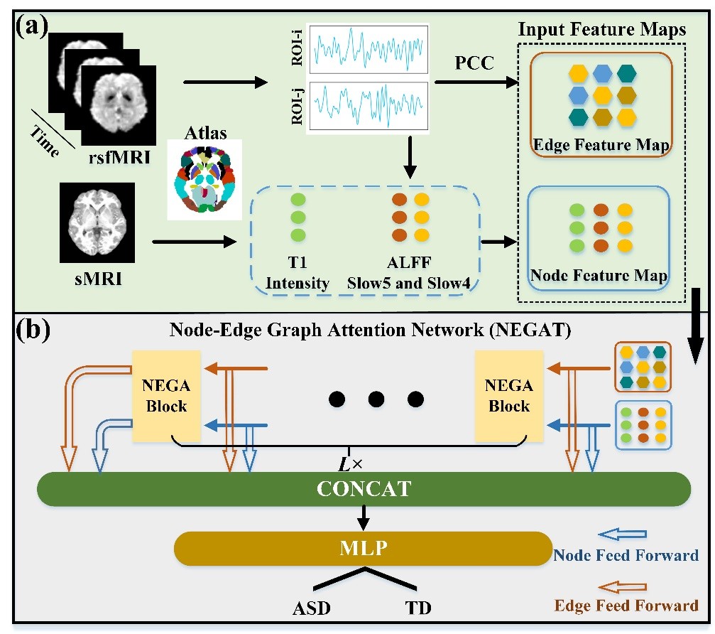 生命学院neuSCAN团队在IEEE顶级期刊发表基于医学影像人工智能的孤独症辅助诊断成果