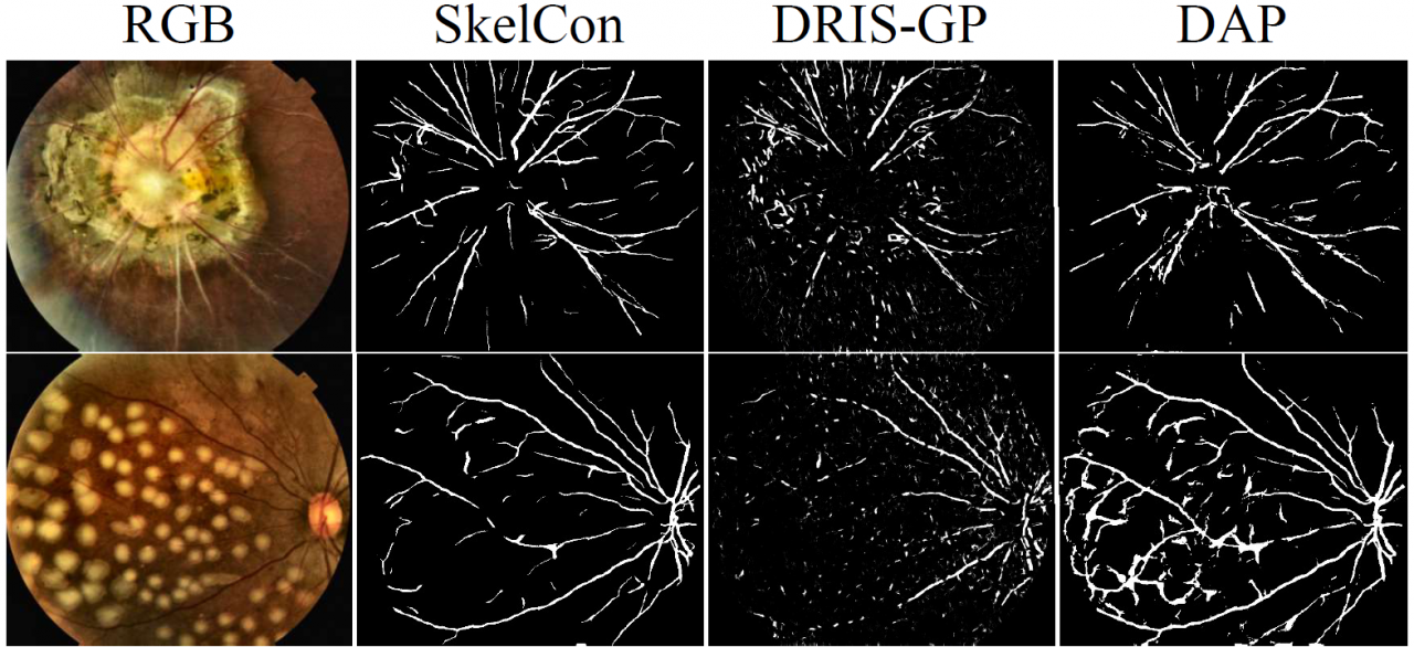 生命学院类脑计算团队在IEEE顶级期刊连续发表两项医学人工智能研究成果